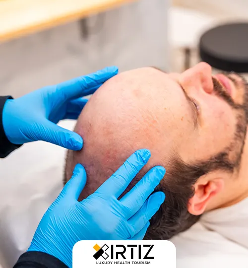 Hear Transplant Treatments in Turkey